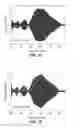 Fig. 06 - Multi-frequency harmonic acoustography for target identification and border detection