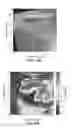 Fig. 09 - Multi-frequency harmonic acoustography for target identification and border detection