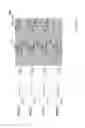 Fig. 08 - Digital differential detection for touch sensors