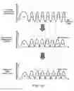 Fig. 17 - Memory system