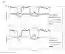 Fig. 01 - Interference suppression using repeated reduced rank adaptive filtering in Fractional Fourier Transform (FrFT) domains