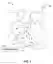 Fig. 02 - Mitigating excessive wakeups in leadless dual-chamber pacing systems and other IMD systems
