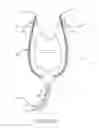 Fig. 22 - Relocation module for patient monitors and surgical equipment