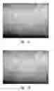 Fig. 02 - METHOD FOR ASSESSING CORNEAL TISSUE QUALITY AND ENDOTHELIAL CELL DENSITY AND MORPHOLOGY