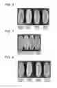 Fig. 04 - METHOD FOR MANUFACTURING MODIFIED GLUTEN