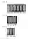 Fig. 05 - METHOD FOR MANUFACTURING MODIFIED GLUTEN