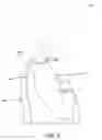 Fig. 06 - Over-the-head disposable contact isolation gown and method for making the same