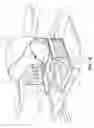 Fig. 02 - Portable Bleacher Seat