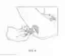 Fig. 05 - Self-Inflating Pellow and thereof