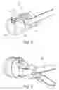 Fig. 04 - DEVICE FOR USE IN HYSTEROSCOPY
