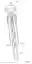 Fig. 08 - Lateral access retractor and core insertion