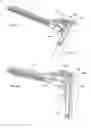 Fig. 22 - Lateral access retractor and core insertion