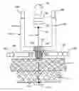 Fig. 01 - METHOD AND DEVICE FOR SECURING BODY TISSUE