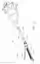 Fig. 03 - Surgical instrument comprising co-operating lockout features