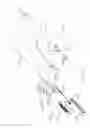 Fig. 08 - Surgical instrument comprising co-operating lockout features