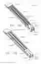 Fig. 115 - Surgical instrument comprising co-operating lockout features