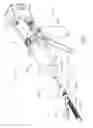Fig. 02 - Surgical stapling assembly comprising a lockout and an exterior access orifice to permit artificial unlocking of the lockout
