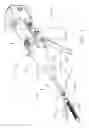 Fig. 02 - Surgical instrument comprising a jaw closure lockout