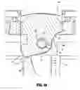 Fig. 34 - Surgical anvil assemblies for surgical stapling instruments