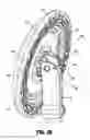 Fig. 35 - Surgical anvil assemblies for surgical stapling instruments