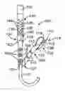 Fig. 01 - Apparatus and method for manipulating stomach tissue and treating gastroesophageal reflux disease