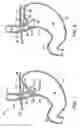 Fig. 02 - Apparatus and method for manipulating stomach tissue and treating gastroesophageal reflux disease