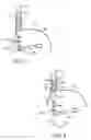 Fig. 05 - Apparatus and method for manipulating stomach tissue and treating gastroesophageal reflux disease