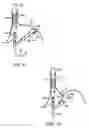 Fig. 06 - Apparatus and method for manipulating stomach tissue and treating gastroesophageal reflux disease