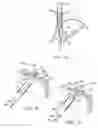 Fig. 08 - Apparatus and method for manipulating stomach tissue and treating gastroesophageal reflux disease
