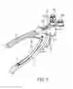 Fig. 02 - Spinal fixation rod bending instrument