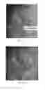 Fig. 18 - Laser system for surgical applications