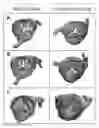 Fig. 01 - Systems and methods for predictive heart valve simulation