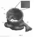 Fig. 06 - Systems and methods for predictive heart valve simulation