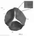 Fig. 07 - Systems and methods for predictive heart valve simulation