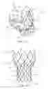 Fig. 02 - Devices and methods for aortic valve preparation prior to transcatheter prosthetic valve procedures