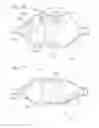 Fig. 09 - Stability device for use with percutaneous delivery systems