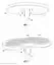 Fig. 02 - MODULAR, ALL-POLY KNEE REPLACEMENT