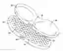 Fig. 01 - Modular, plastic knee replacement with locking mechanism