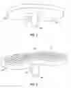 Fig. 02 - Modular, plastic knee replacement with locking mechanism