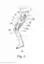 Fig. 07 - Orthopedic device