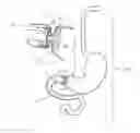 Fig. 01 - Systems and methods for anchoring and restraining gastrointestinal prostheses