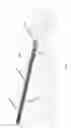 Fig. 09 - Systems and methods for anchoring and restraining gastrointestinal prostheses
