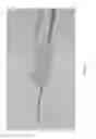Fig. 22 - Systems and methods for anchoring and restraining gastrointestinal prostheses