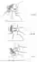 Fig. 06 - Dynamic mounting mechanism for an exoskeleton