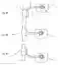 Fig. 09 - Dynamic mounting mechanism for an exoskeleton
