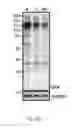Fig. 03 - METHOD AND KIT FOR MYOCARDIAL REPERFUSION, AND METHOD FOR ATTENUATING OR REDUCING MYOCARDIAL REPERFUSION INJURY