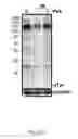 Fig. 05 - METHOD AND KIT FOR MYOCARDIAL REPERFUSION, AND METHOD FOR ATTENUATING OR REDUCING MYOCARDIAL REPERFUSION INJURY