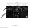 Fig. 13 - METHOD AND KIT FOR MYOCARDIAL REPERFUSION, AND METHOD FOR ATTENUATING OR REDUCING MYOCARDIAL REPERFUSION INJURY
