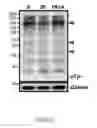 Fig. 33 - METHOD AND KIT FOR MYOCARDIAL REPERFUSION, AND METHOD FOR ATTENUATING OR REDUCING MYOCARDIAL REPERFUSION INJURY