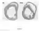 Fig. 46 - METHOD AND KIT FOR MYOCARDIAL REPERFUSION, AND METHOD FOR ATTENUATING OR REDUCING MYOCARDIAL REPERFUSION INJURY
